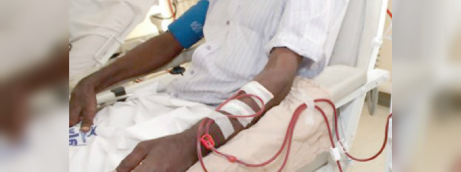26,652 chronic kidney patients in Sri Lanka 