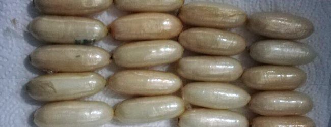 Fifty-two cocaine capsules retrieved from an abdomen of 52-year-old
