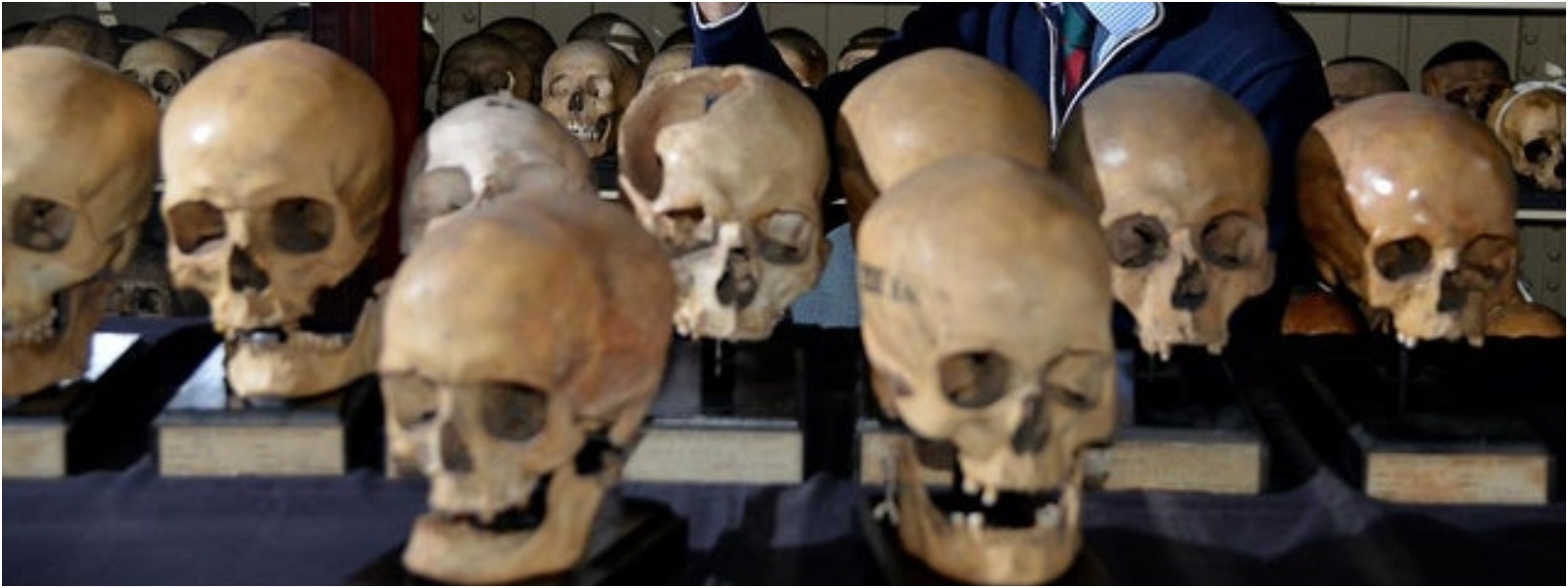 200 year old human skulls make their way back to Sri Lanka from Edinburgh University