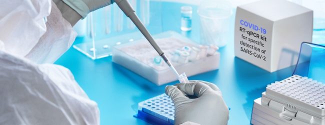 03 Universities to start PCR testing in SL