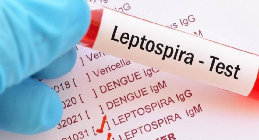 Burden of leptospirosis severely underestimated in Sri Lanka – study