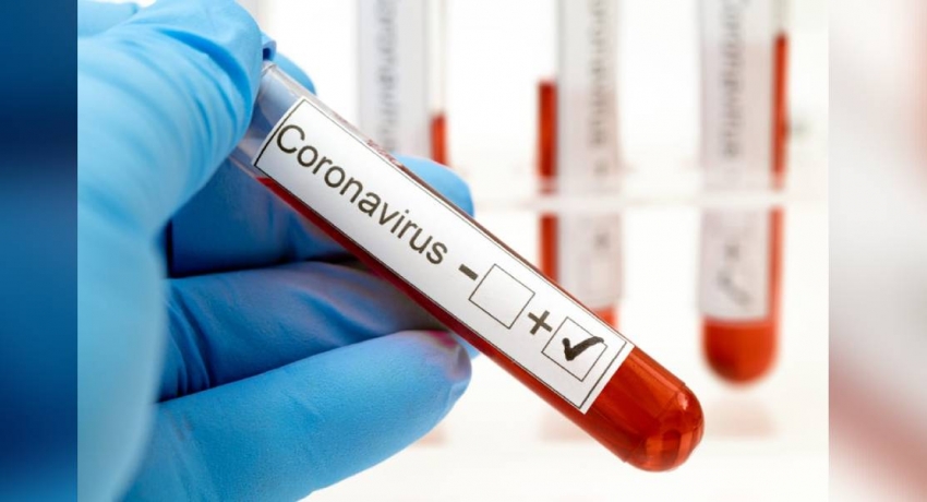Four private hospitals to conduct testing for COVID-19