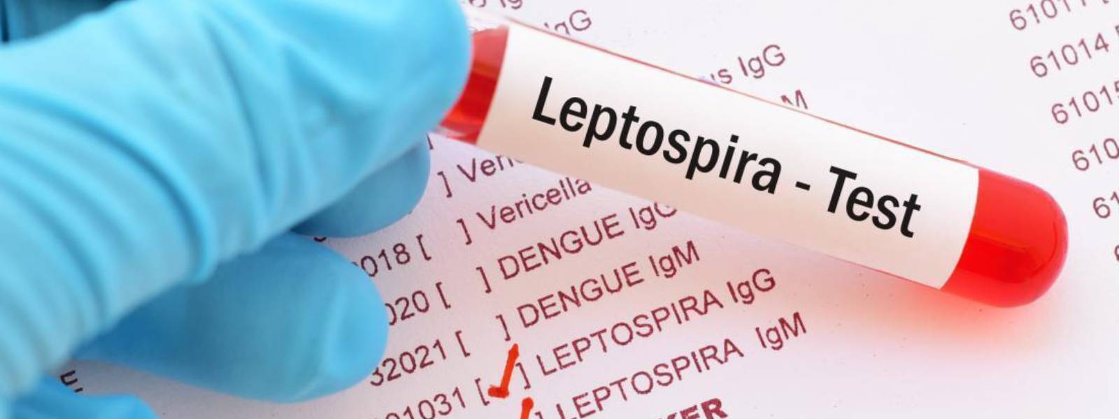 Burden of leptospirosis underestimated - study