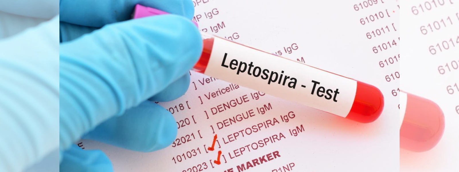 12 deaths due to Leptospirosis this year: Ministry of Health