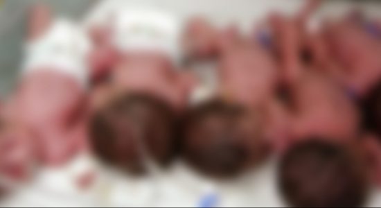 Quintuplets born at the De Soysa Hospital for Women