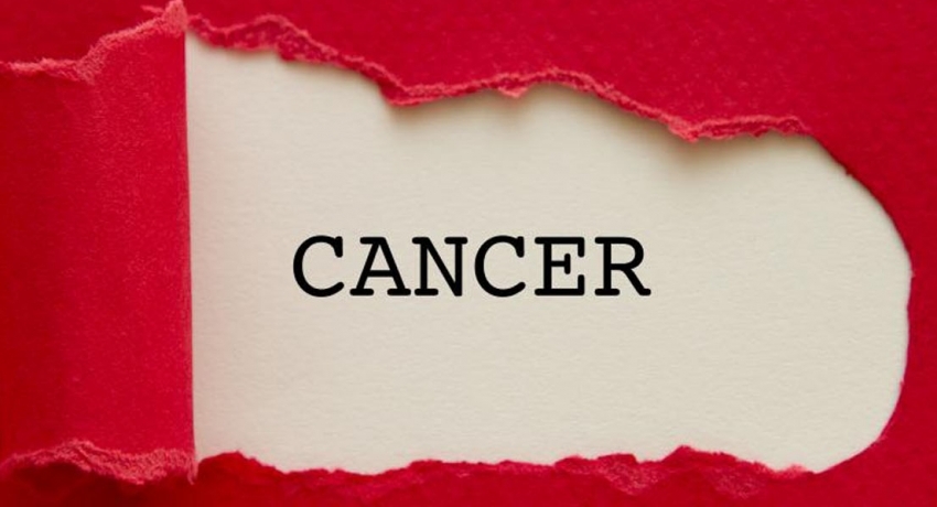 64 cancer patients reported daily in Sri Lanka