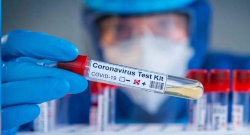 Concerns raised over imported Rapid Antigen Test kits