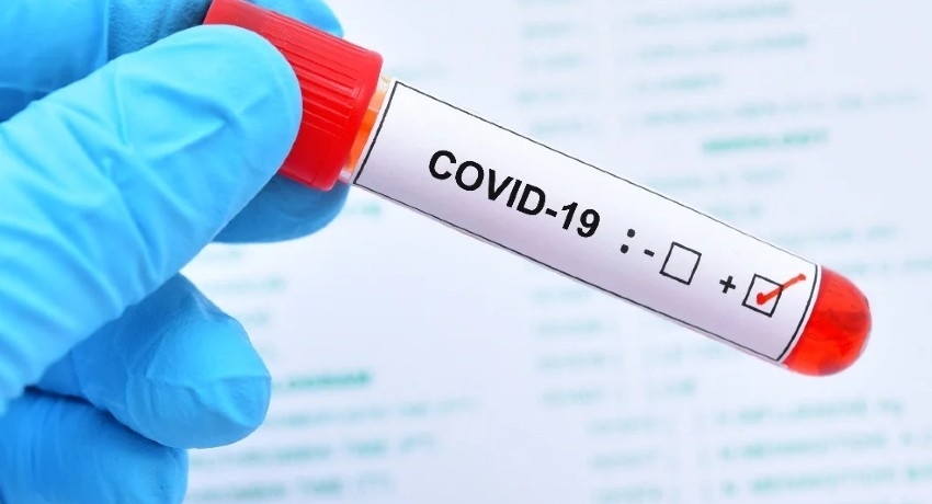 COVID TESTS AT W/PROVINCE EXITS DETECT 16 PATIENTS