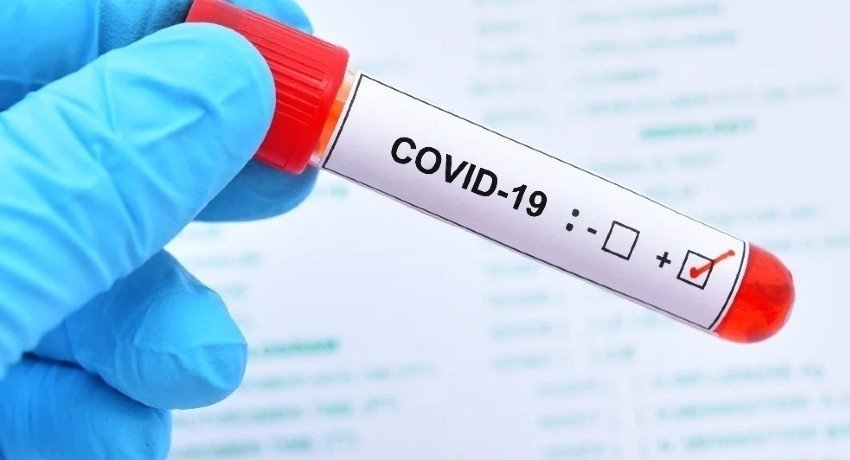 COVID-19 VARIANT DETECTED IN SRI LANKA