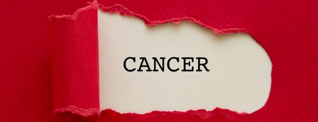 Alarming surge in daily cancer detections in SL
