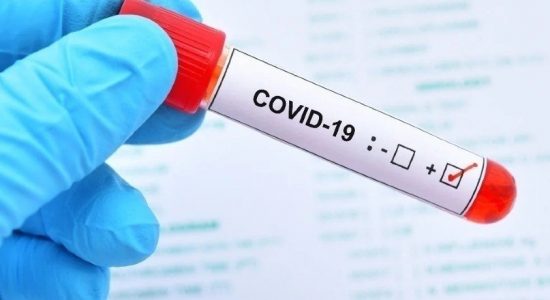 151 COVID patients from Colombo on Friday (26)