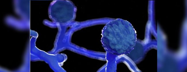 Indian fungal disease is not found in Sri Lanka: Ministry of Health