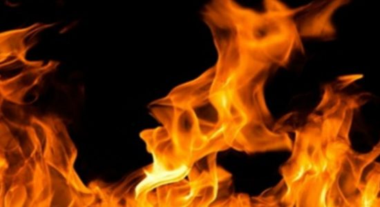 19-year old youth injured in apartment fire