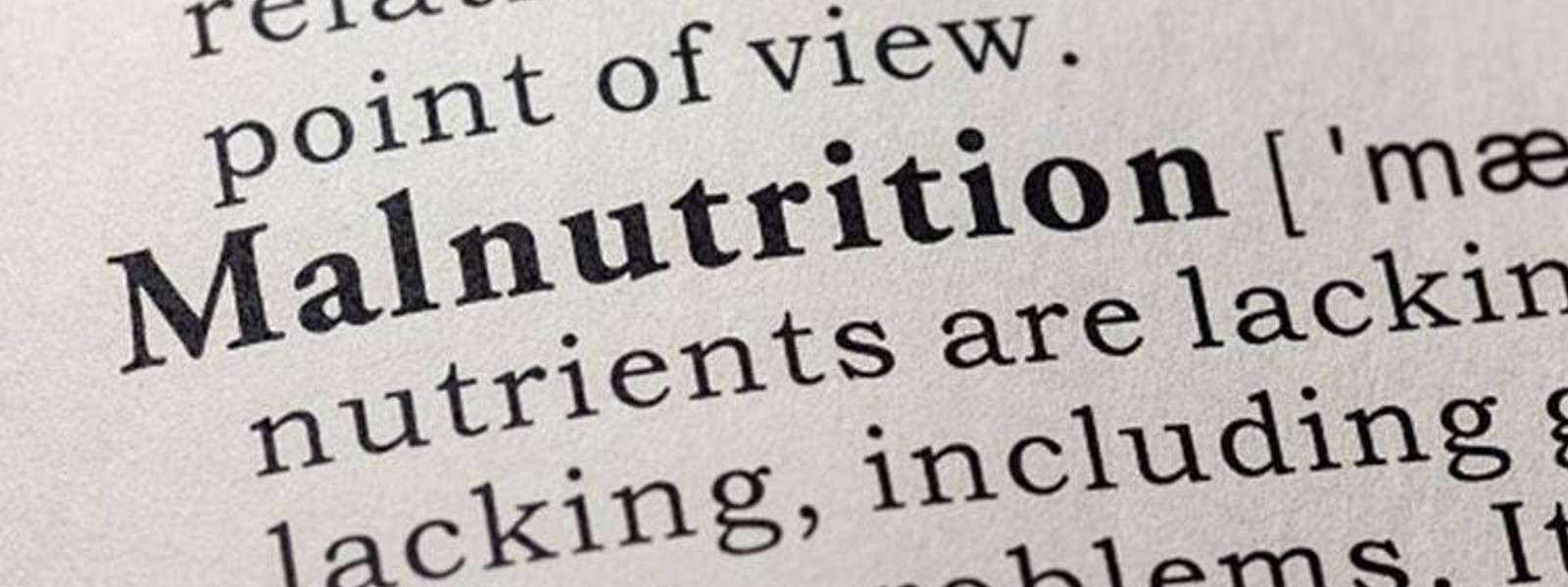 Malnutrition developing into a more complex issue: Dr. Jayaruwan Bandara