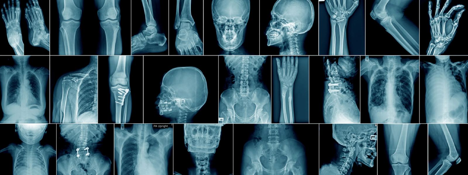 Sri Lankan hospitals running out of X-Ray films