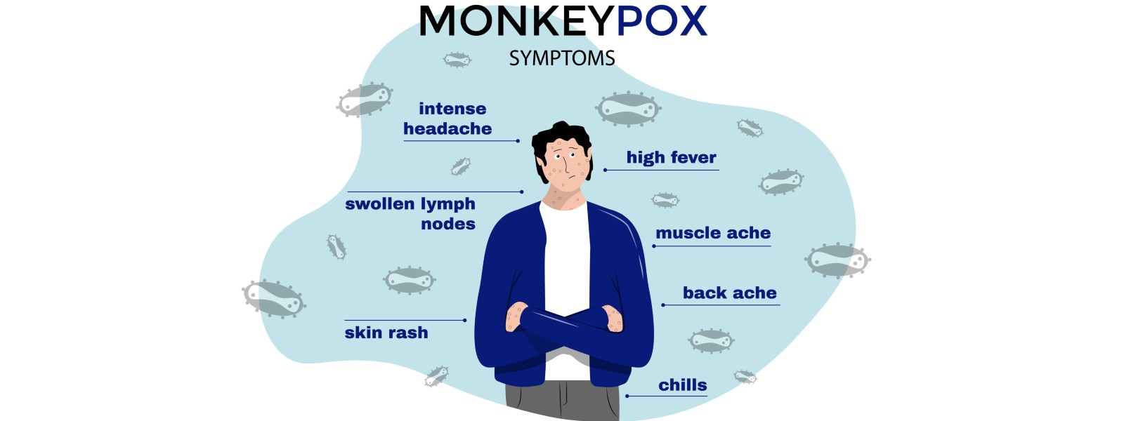 Monkeypox: Sri Lankan confirms second case