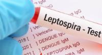 MOH Takes Action as Leptospirosis Cases Rise