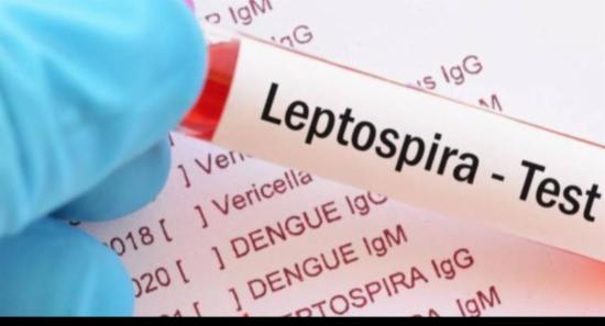 A'pura Records 10 Leptospirosis Deaths In 2025