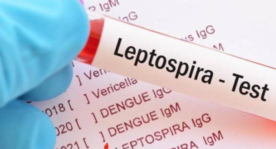 1,800 Cases of Rat Fever (Leptospirosis) Reported