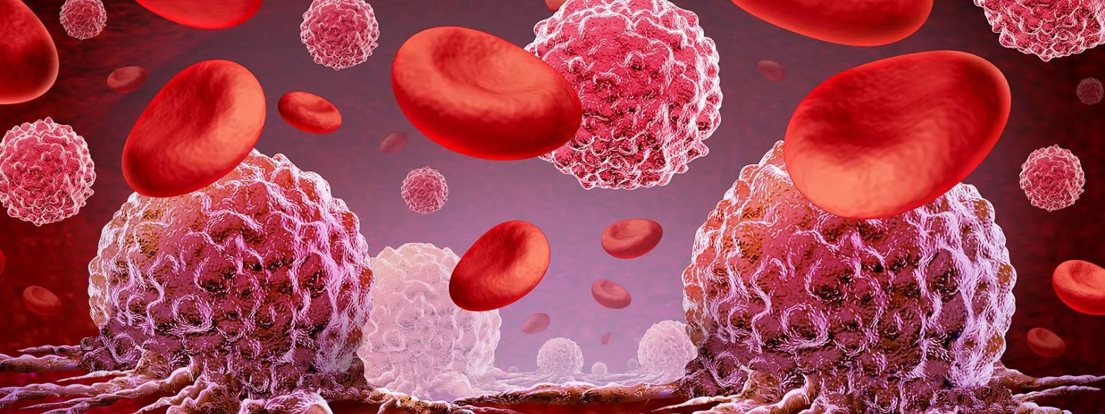 Leukaemia Among Common Cancers Affecting Children