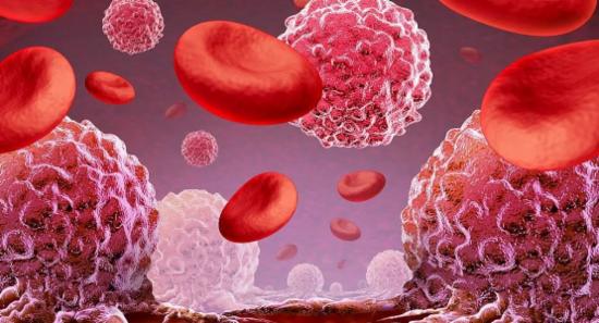 Leukaemia Among Common Cancers Affecting Children