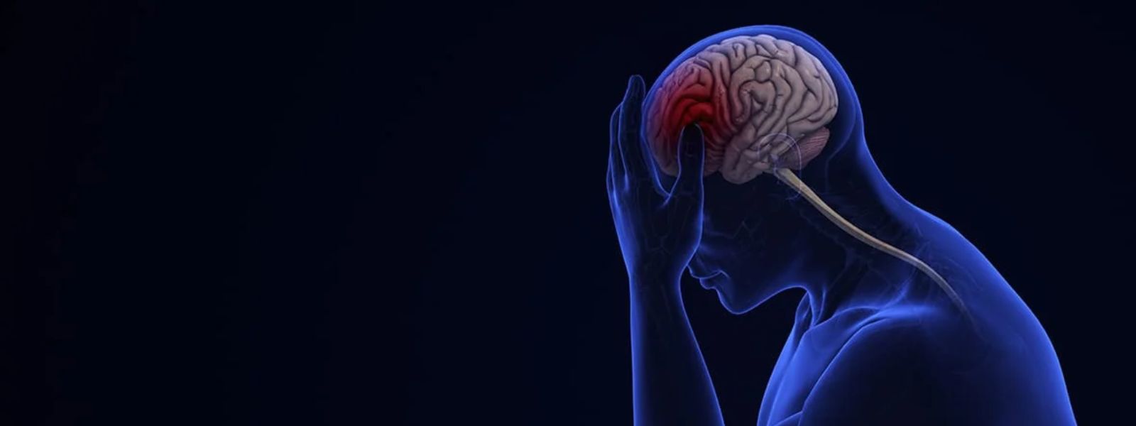 Stroke Remains One of Sri Lanka's Deadliest Threat