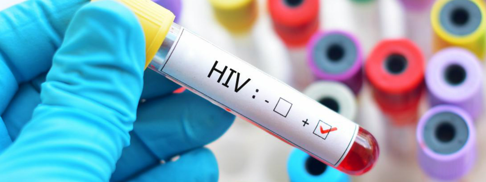 HIV ආසාදිතයින් හඳුනා ගැනීමේ පරීක්ෂණ යළිත්