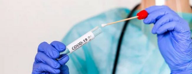 ගෙවුණු දිනයේ PCR පරීක්‍ෂණ 10,514ක්..  