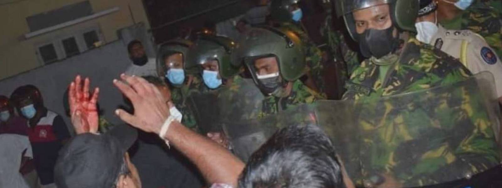 මිරිහානේ සැකකරුවන් හඳුනා ගැනීමට නොහැකි වෙයි