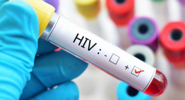 මෙරට HIV ආසාදිතයින් දෙගුණයකින් ඉහළට