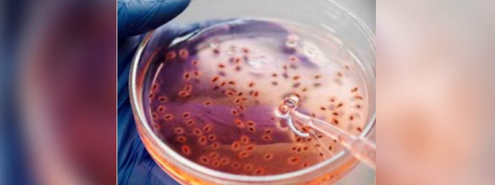 පාංශු උණ ගැන බොහෝ දෙනෙකු දැනුවත් නෑ..