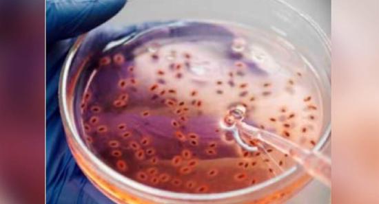 පාංශු උණ ගැන බොහෝ දෙනෙකු දැනුවත් නෑ..