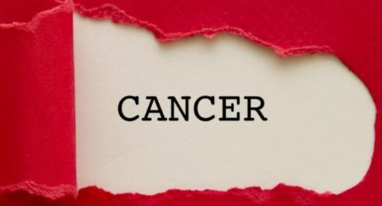 වාර්ෂිකව මෙරටින් ළමා පිලිකා රෝගීන් 900ක්