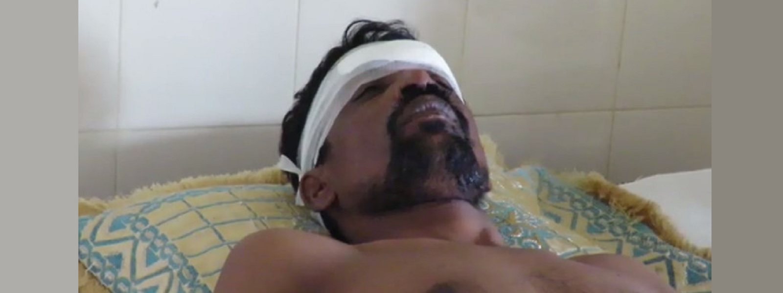 கொடிகாமத்தில் வாள்வெட்டுத்தாக்குதலில் ஒருவர் காயம்