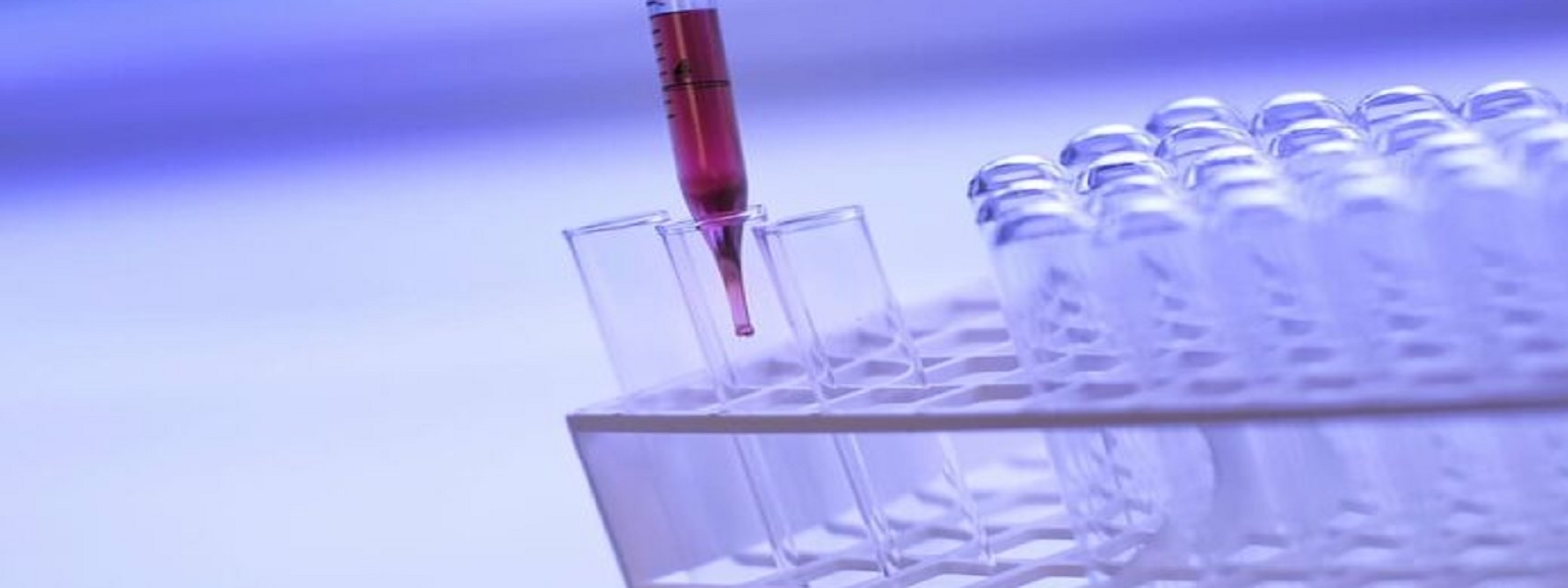 தனியாருக்கு PCR மாதிரிகளை அனுப்புவது சிக்கலானது