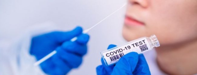 PCR மற்றும் Antigen பரிசோதனைகளுக்கான அதிகபட்ச கட்டணம் நிர்ணயம்