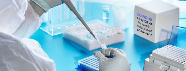 Rapid PCR பரிசோதனை இயந்திர கொள்வனவை சுகாதார அமைச்சு தாமதிக்கின்றதா?