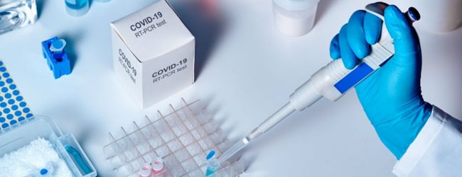 PCR மற்றும் Antigen பரிசோதனைகளுக்கு நிர்ணய விலை அறிவிக்கப்படவுள்ளது