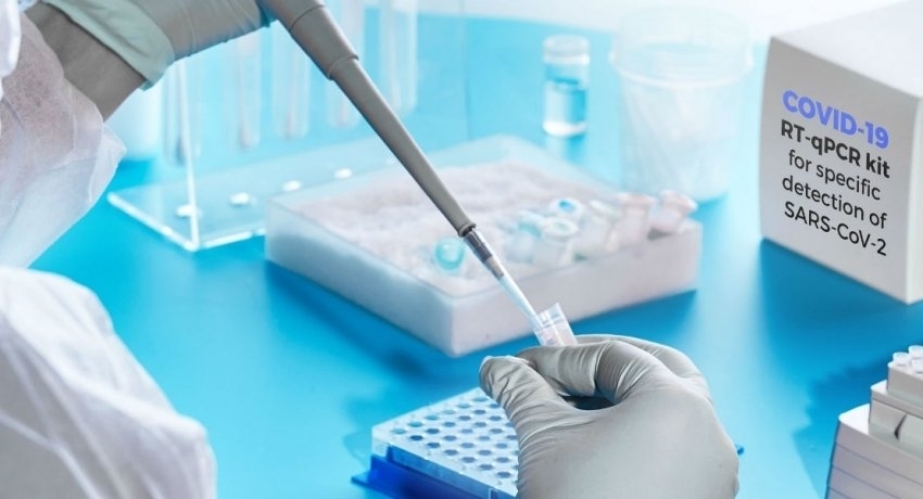 PCR பரிசோதனைக்கு விசேட சுற்றுநிருபம்